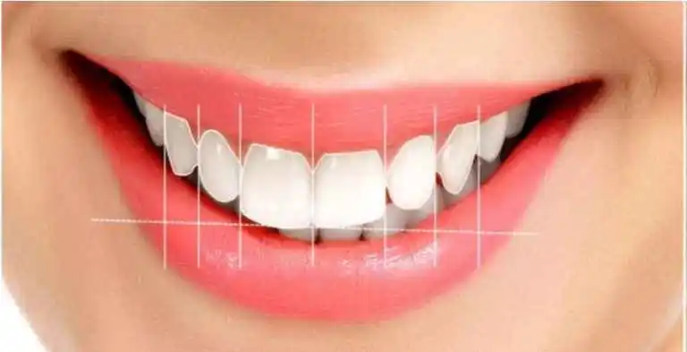 Smile design & digital mock-up