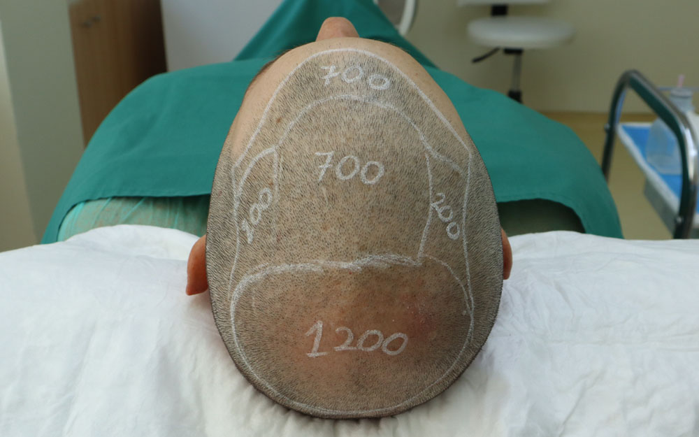 Assessment & planning