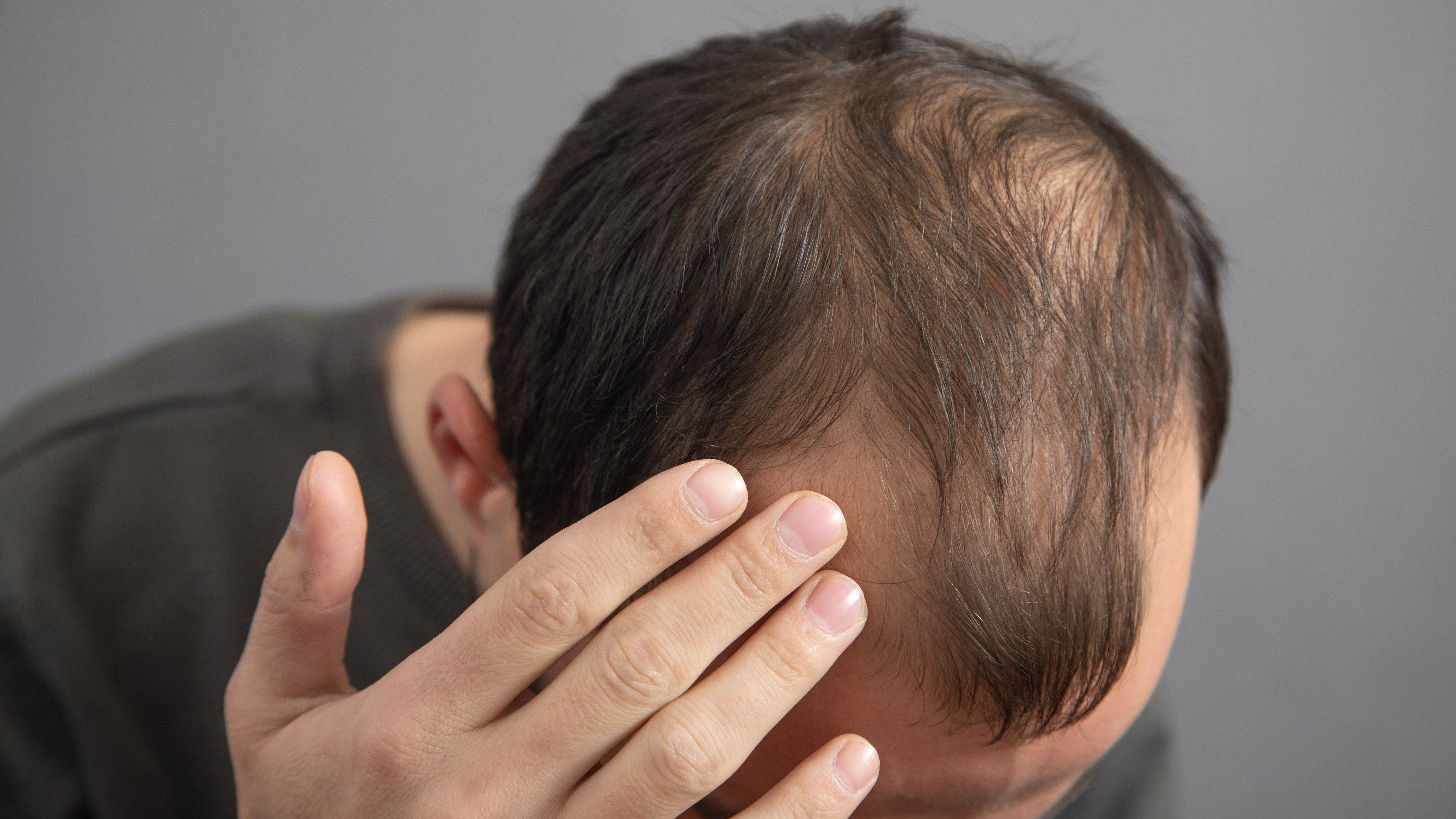Hair and scalp assessment